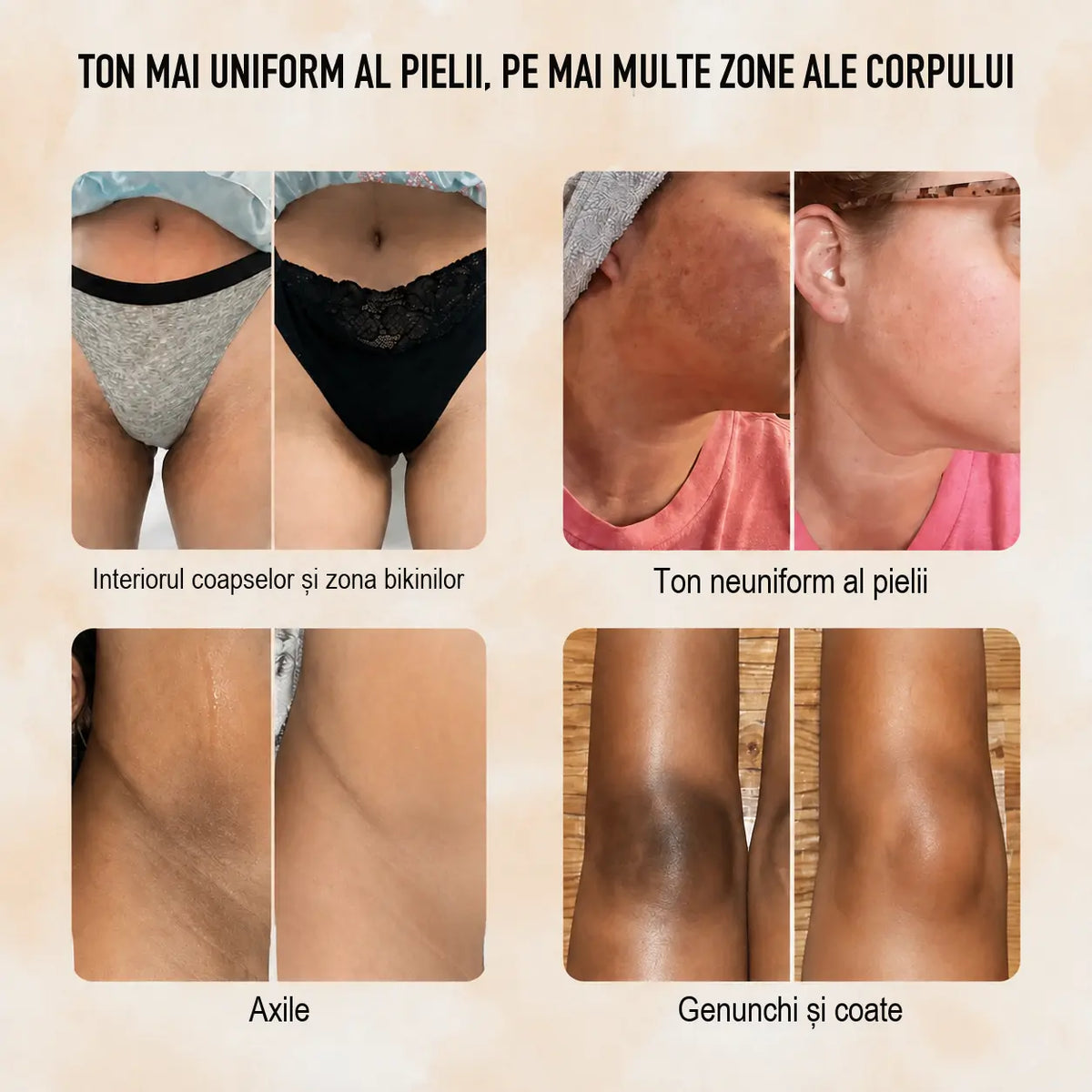 Săpun cu turmeric și acid kojic – pentru uniformizarea nuanței pielii